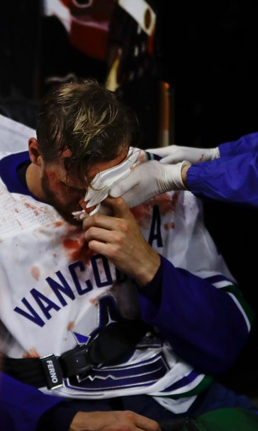 Canucks defenseman Edler sidelined by a concussion